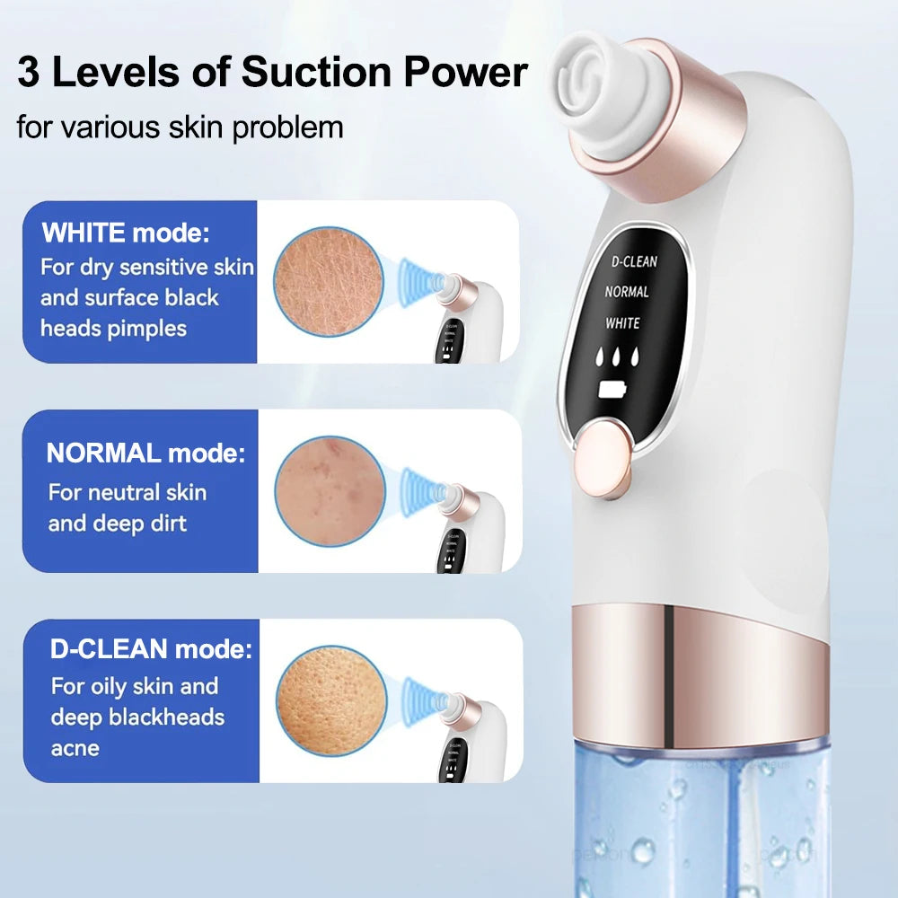 Blackhead Remover Vacuum