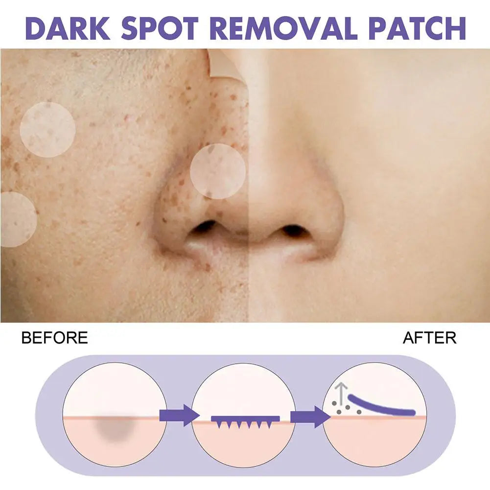 Dark Spot Removal Patch