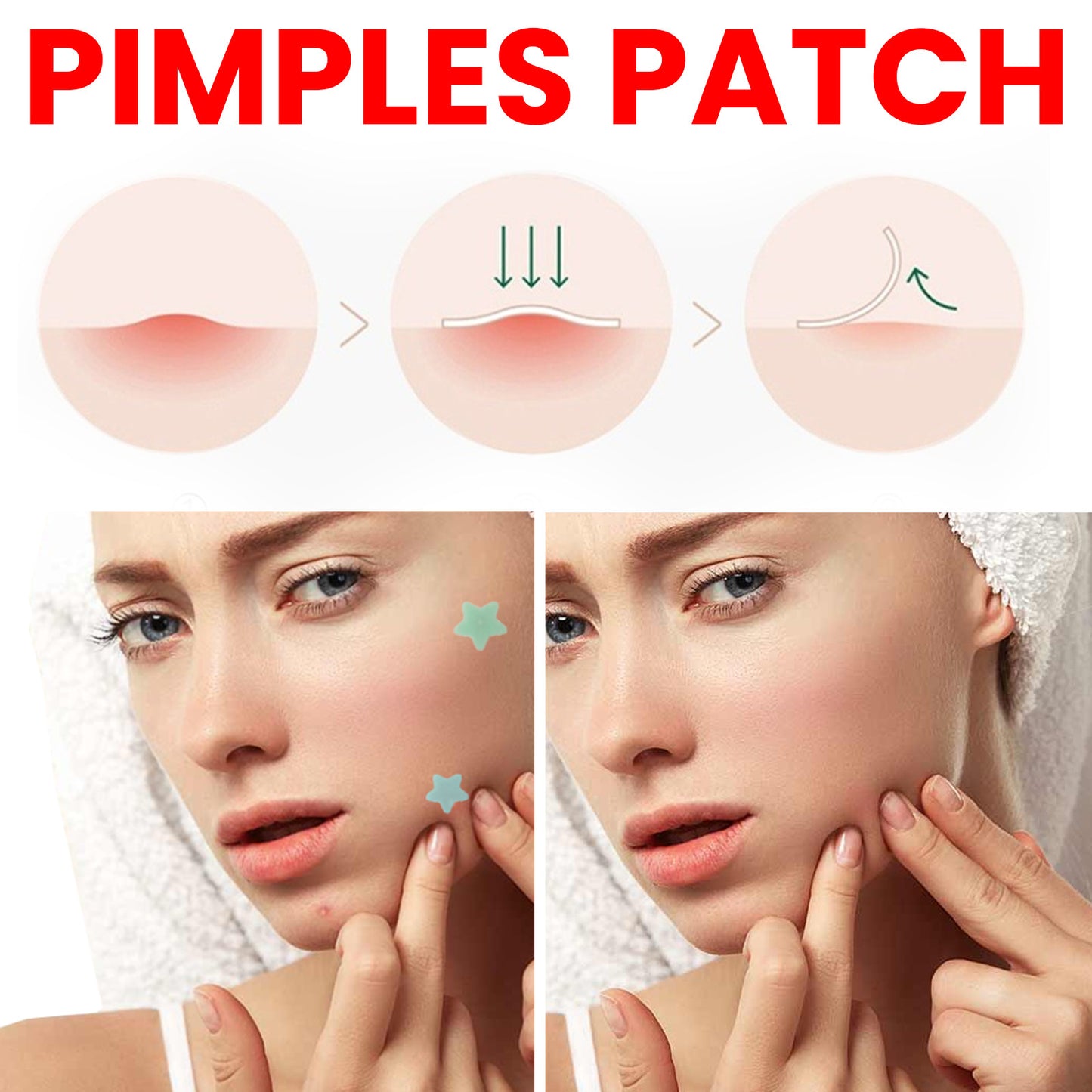 Blemish Spot Patches - Star Shaped Hydrocolloid Stickers | 200 Count Pack